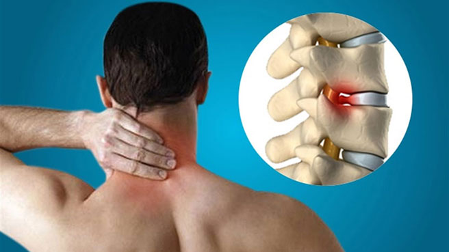 Đặc điểm của các đốt sống cổ